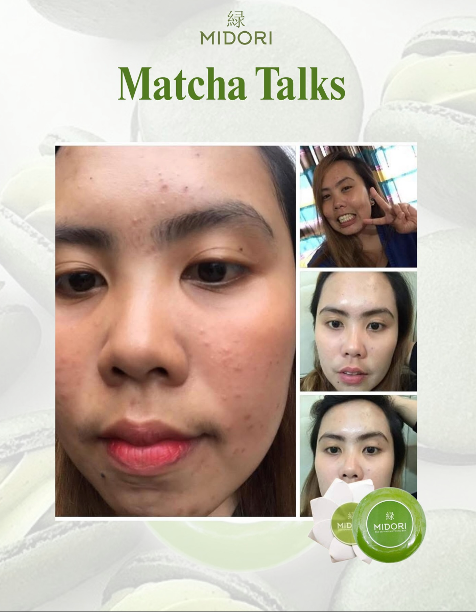 Beauty Collagen Matcha and Lemonade + Midori Matcha Glycerin Soap Combo