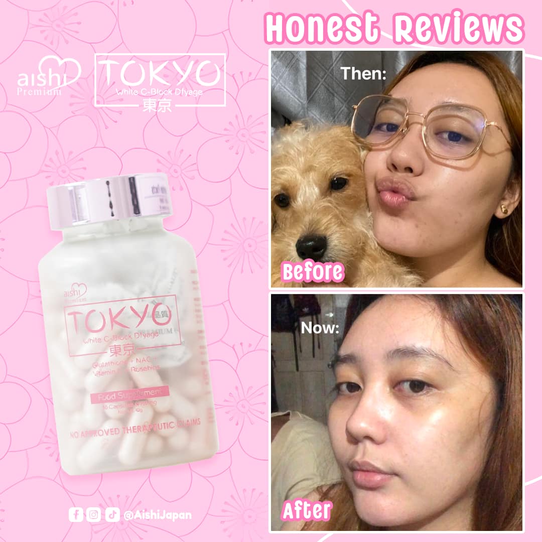 AISHI TOKYO WHITE CAPS